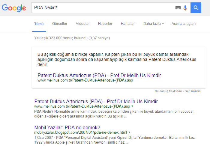 pda nedir